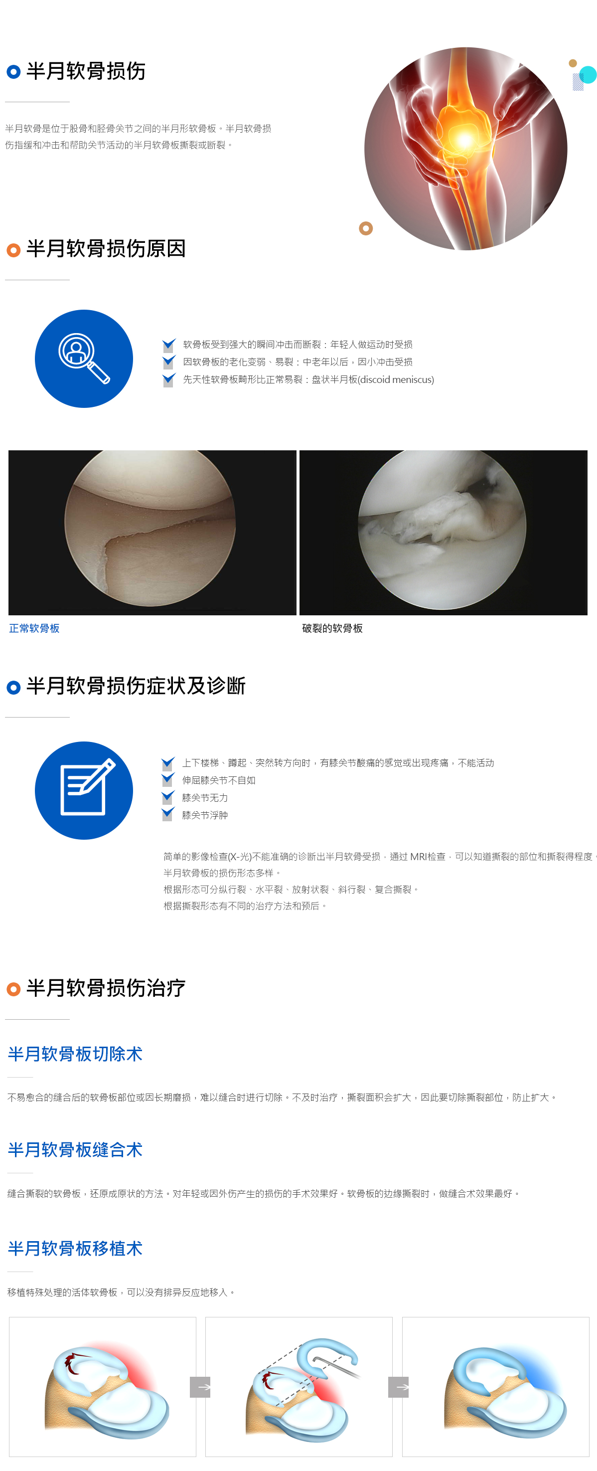 반월상연골손상