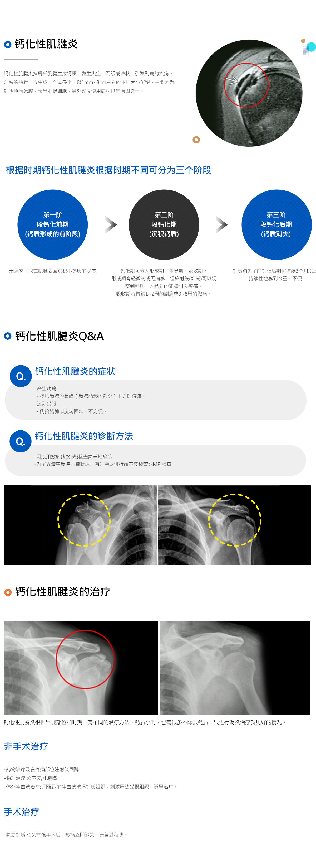 석회성건염