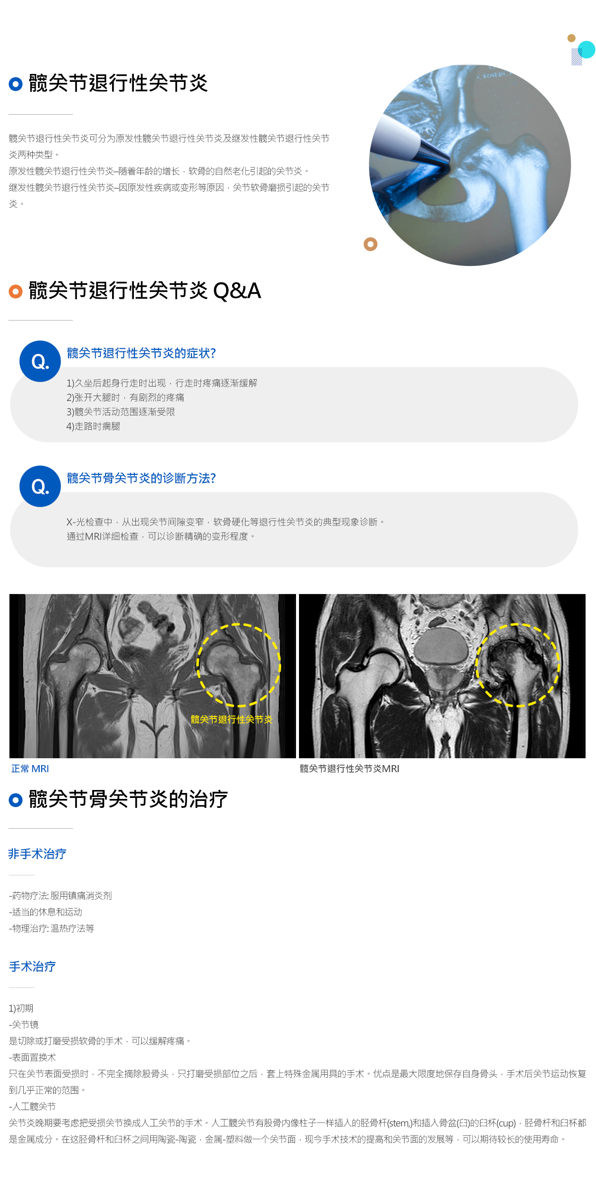 퇴행성 고관절염