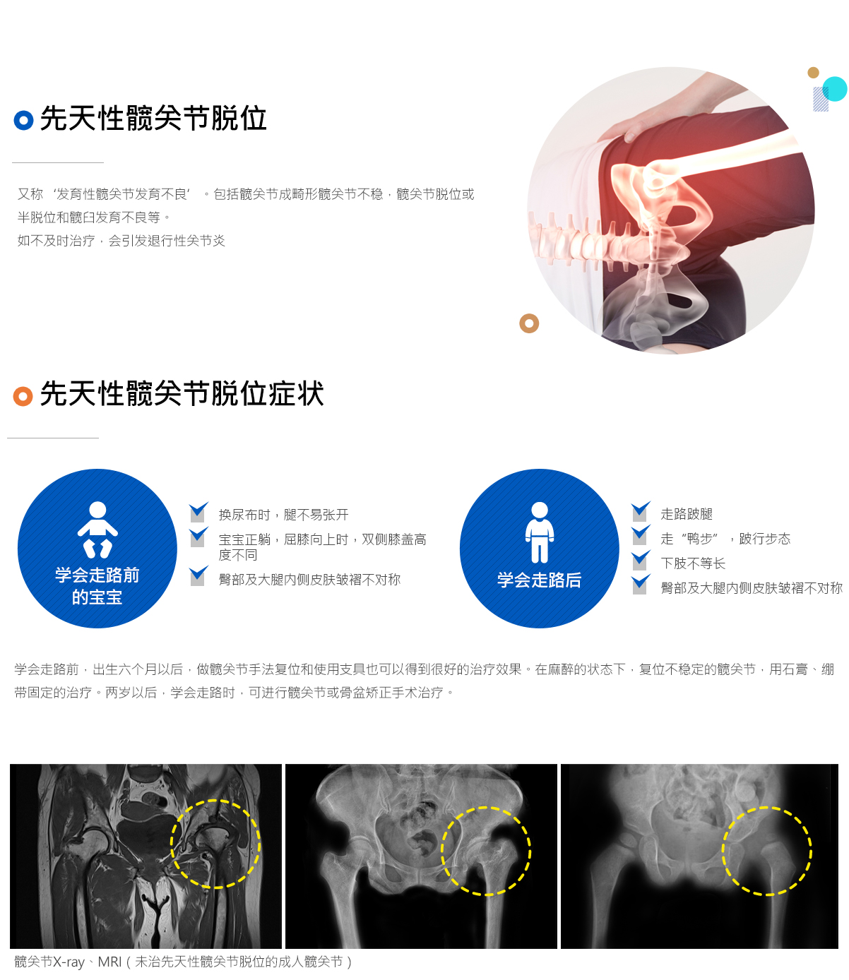 기타질환(고관절 이형성증, 점액낭염 )