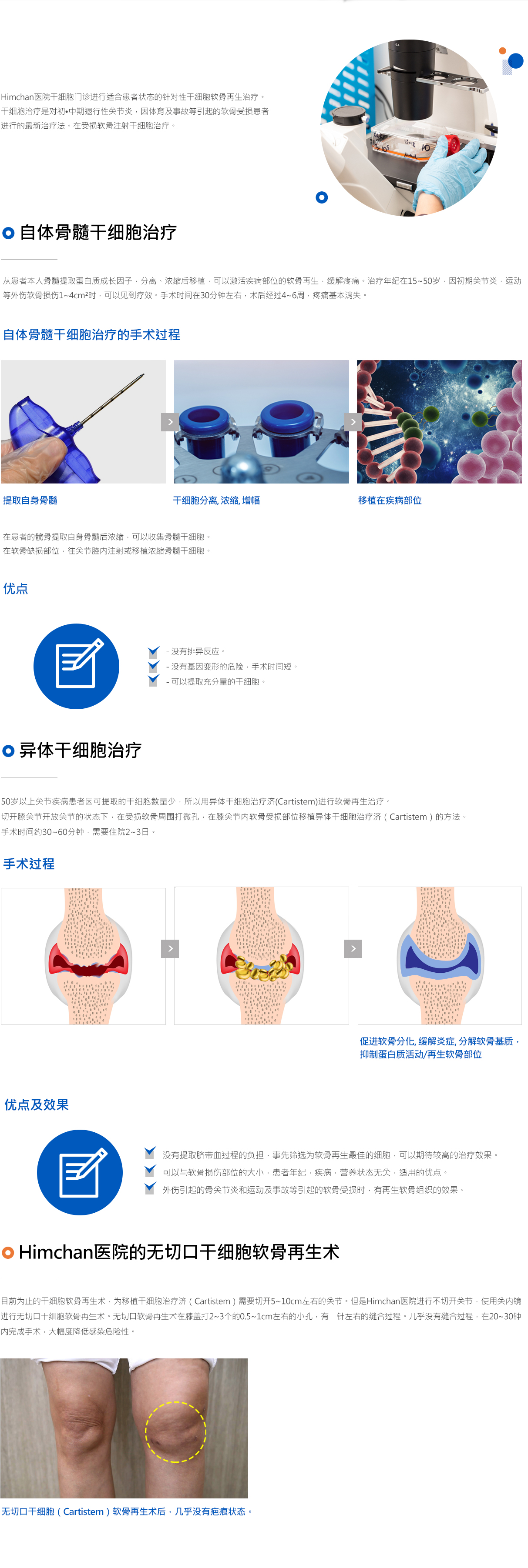 연골재생(줄기세포)