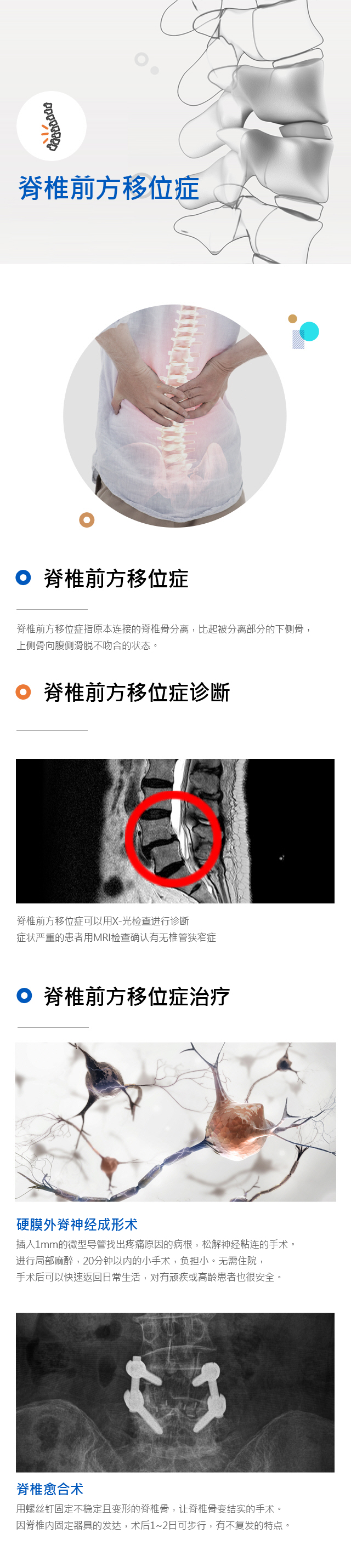 Spondylolisthesis